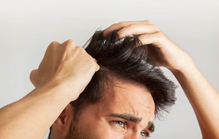 Male androgenic + other hair loss concerns - Anthony Pearce Trichology